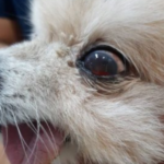 น้องสรยุทธ กับภาวะเลือดออกในช่องม่านตา (Hyphema)